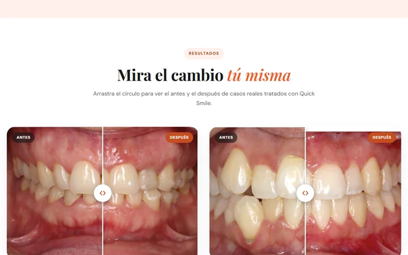 Antes y después con deslizador en la web de Dental One